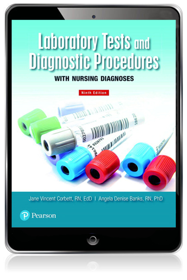Laboratory Tests and Diagnostic Procedures with Nursing Diagnoses with Nursing Diagnoses (Subscription)
