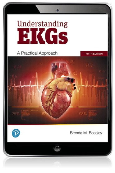 Understanding EKGs: A Practical Approach (Subscription)
