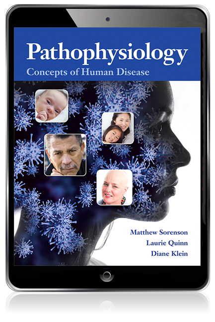 Pathophysiology: Concepts of Human Disease (Subscription)